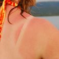 Random Fact of The Day: This Every Day Household Item Is an Effective Treatment for Sunburn