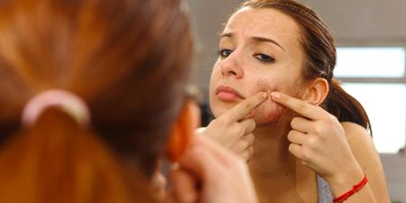 Apparently You Should Never Pop a Pimple and Here is Why
