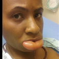 Woman shares Facebook post after suffering alarming allergic reaction to lipstick