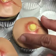 Zit-popping inspired cakes are a thing now and they look revolting