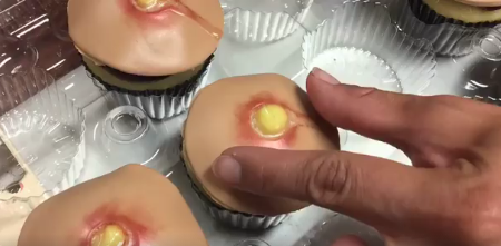 Zit-popping inspired cakes are a thing now and they look revolting