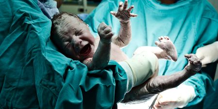 A new birthing method sees babies “walking” out of the womb