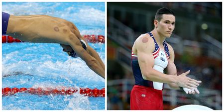 This is why Olympians have those red marks on their bodies