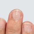 Here are the reasons why you may have white marks on your nails