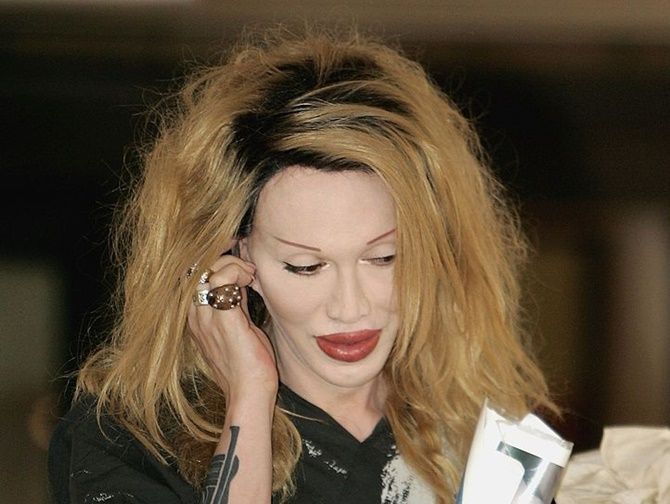 R.I.P. Pete Burns, You Spin Me Round singer has died at 57