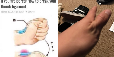 People are trying to break their thumbs because of this stupid Internet picture