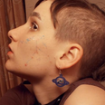 Constellation acne is the new way women are embracing their skin