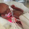 Weighing just 300g at birth, ‘miracle’ baby Poppy finally goes home