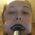 This teen got a hammer stuck in her mouth for the most bizarre reason