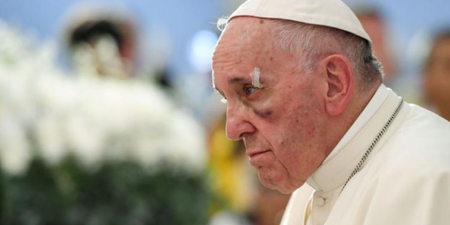 ‘I got bashed’ Pope Francis jokes as he appears with a black eye