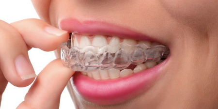 Why you should be wearing your retainer for the rest of your life