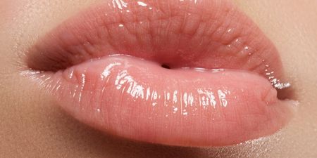 The country most obsessed with lip fillers revealed (PS no one is surprised)