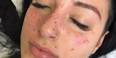 Tattooing freckles of your astrology sign is now a thing and we’re fairly confused