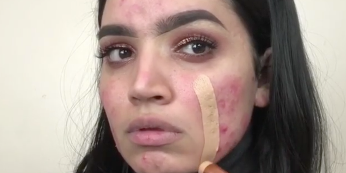 A budget foundation that promises to cover redness is causing a stir online