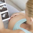 Pregnant women are using an odd technique to figure out the sex of their baby