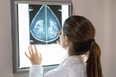 Breast cancer screening failure means 270 women in UK may have had lives ‘shortened’