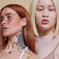 Missguided’s latest body positive campaign highlights common skin conditions