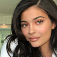 Kylie admits that she got rid of ALL her lip filler and she looks like the old her