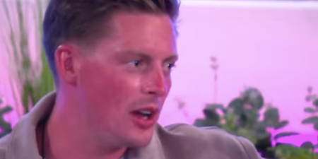 Dr Alex says he got really sunburnt in the Love Island villa because of a ‘skin condition’