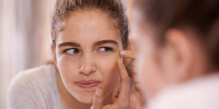 Research looked at the effect acne had on people growing up – and it’s not good
