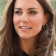 Here’s how Kate Middleton got the pretty big scar on her forehead