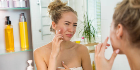 Woman finds the weirdest, most bizarre way to get rid of her spots