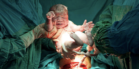 First ever baby born via womb transplant from deceased donor