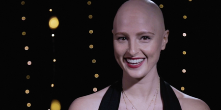 ‘Within a year, my entire head of hair was gone’: how model Amber Jean Rowan overcame her biggest insecurity