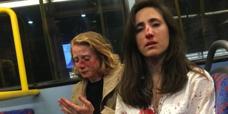 Arrests made after lesbian couple beaten up by men for refusing to kiss