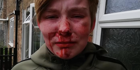 Woman and girl arrested following alleged homophobic assault on teenager in Yorkshire