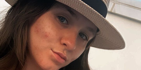 Brooke Vincent speaks candidly about struggling with her post-baby body