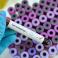 Four cases of coronavirus confirmed in the west of Ireland