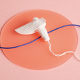 A gynaecologist has given the tampon its first notable redesign in 80 years
