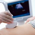 Partners to be allowed to attend 20 week scans, says HSE
