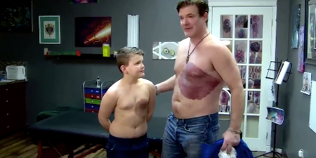 Dad gets son’s birthmark tattooed onto his body to help boost his self-esteem