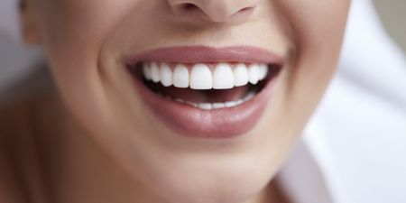 Always wanted a perfect smile? Here’s how to get straight teeth at home in lockdown