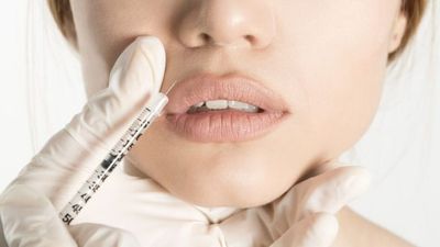 Influencer shares shocking results of when botox goes wrong