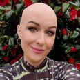 “It changed my relationship with beauty”: Journalist Mary Cate Smith discusses her alopecia journey