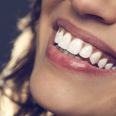 Want to smile with confidence? Here’s how you can conveniently straighten your teeth at home