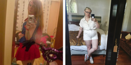 My battle with body dysmorphia stole my teenage years from me