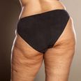 Cellulite is completely normal – but why do we get it?