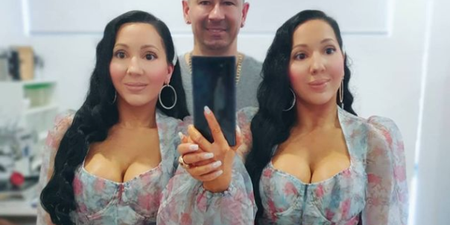 World’s ‘most identical twins’ want to become pregnant by same fiancé