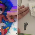 11oz baby becomes the smallest tot to survive in the UK