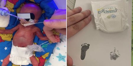 11oz baby becomes the smallest tot to survive in the UK