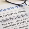 WHO advisor identifies possible source of Monkeypox outbreak