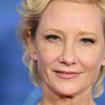 Actress Anne Heche “not expected” to survive coma