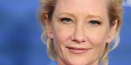 Actress Anne Heche “not expected” to survive coma