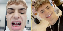 Man’s warning after Turkey teeth surgery leaves him looking ‘like a shark’