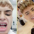 Man’s warning after Turkey teeth surgery leaves him looking ‘like a shark’