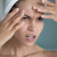 Dermatologist reveals the type of spot you really should leave alone
